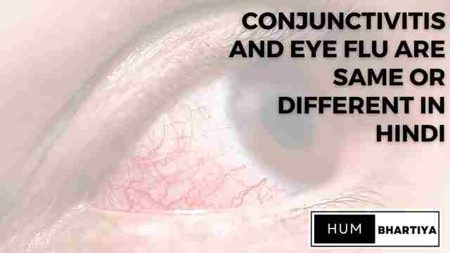 Conjunctivitis and Eye Flu are Same or Different in Hindi